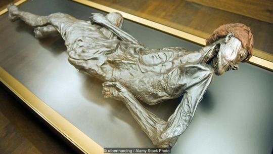 Xác người đàn ông bị cắt cổ họng ở Bảo tàng Moesgaard Ảnh: ALAMY STOCK