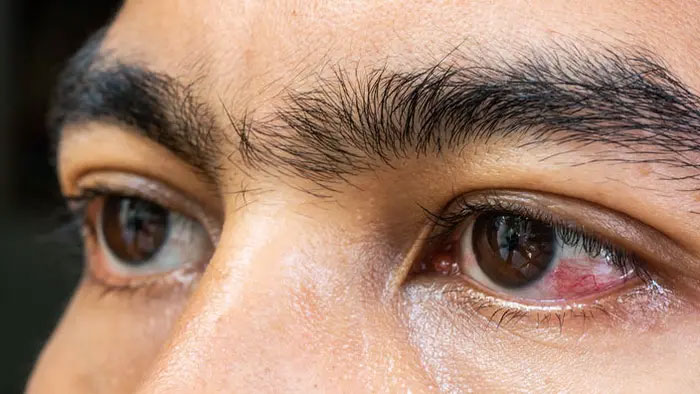 Hai mắt của người mọc ở trên mặt là kết quả của cả một quá trình tiến hóa lâu dài.