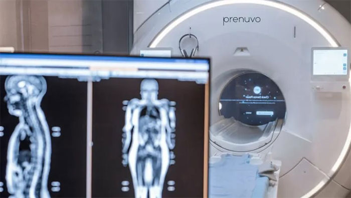  Chụp cộng hưởng từ (MRI) toàn thân tại Prenuvo. 