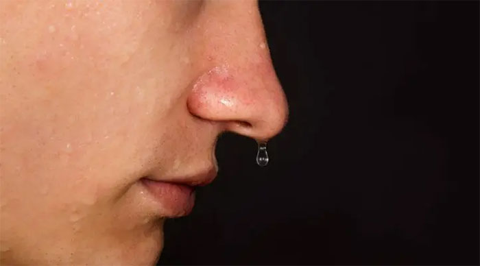  Dựa vào nguyên nhân gây chảy nước mũi là gì mà phương pháp điều trị sẽ khác nhau. 
