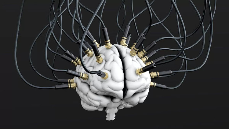 Các điện cực gắn vào não bộ, cho phép máy móc đọc được sóng não và chuyển thành văn bản.