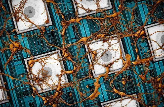 Hình ảnh của neuron thần kinh chuột trên CNEA (mảng điện cực nano CMOS).